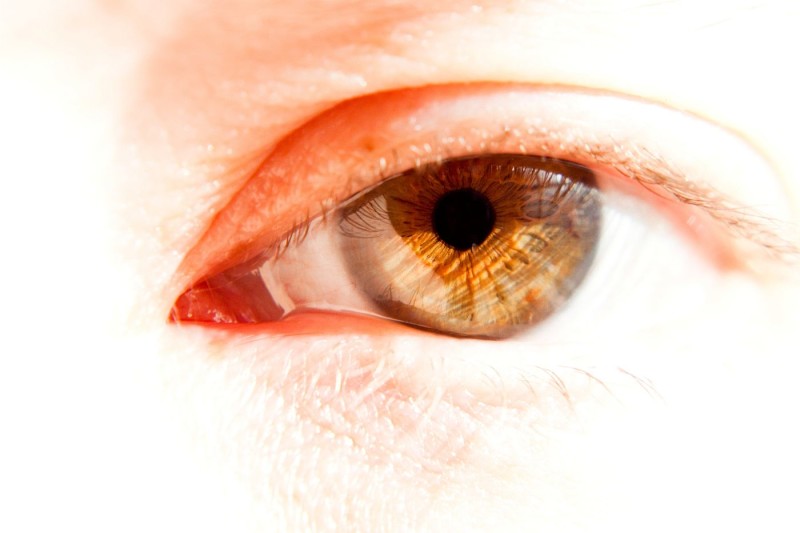 Eye